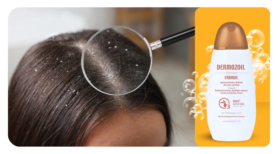 Dermozoil šampón a hlava ženy s lupy, které pomáhá eliminovat