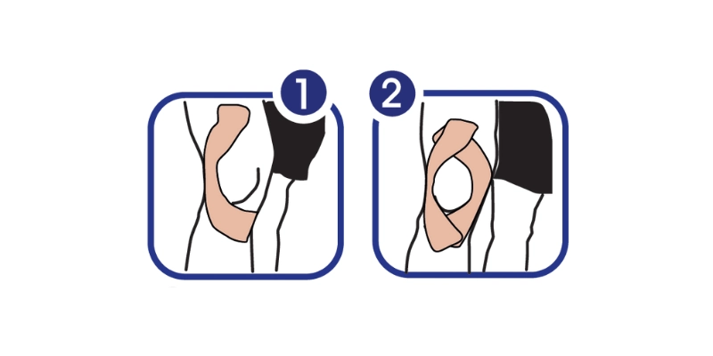 Ukázka správné aplikace tejpovací pásky Dolaren při bolesti kolene.