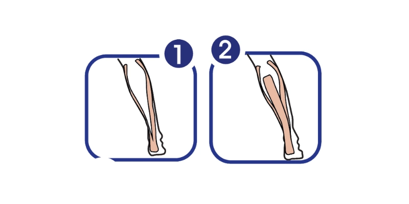 Ukázka správné aplikace tejpovací pásky Dolaren při bolesti lýtka.