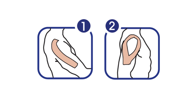 Ukázka správné aplikace tejpovací pásky Dolaren při bolesti ramene.