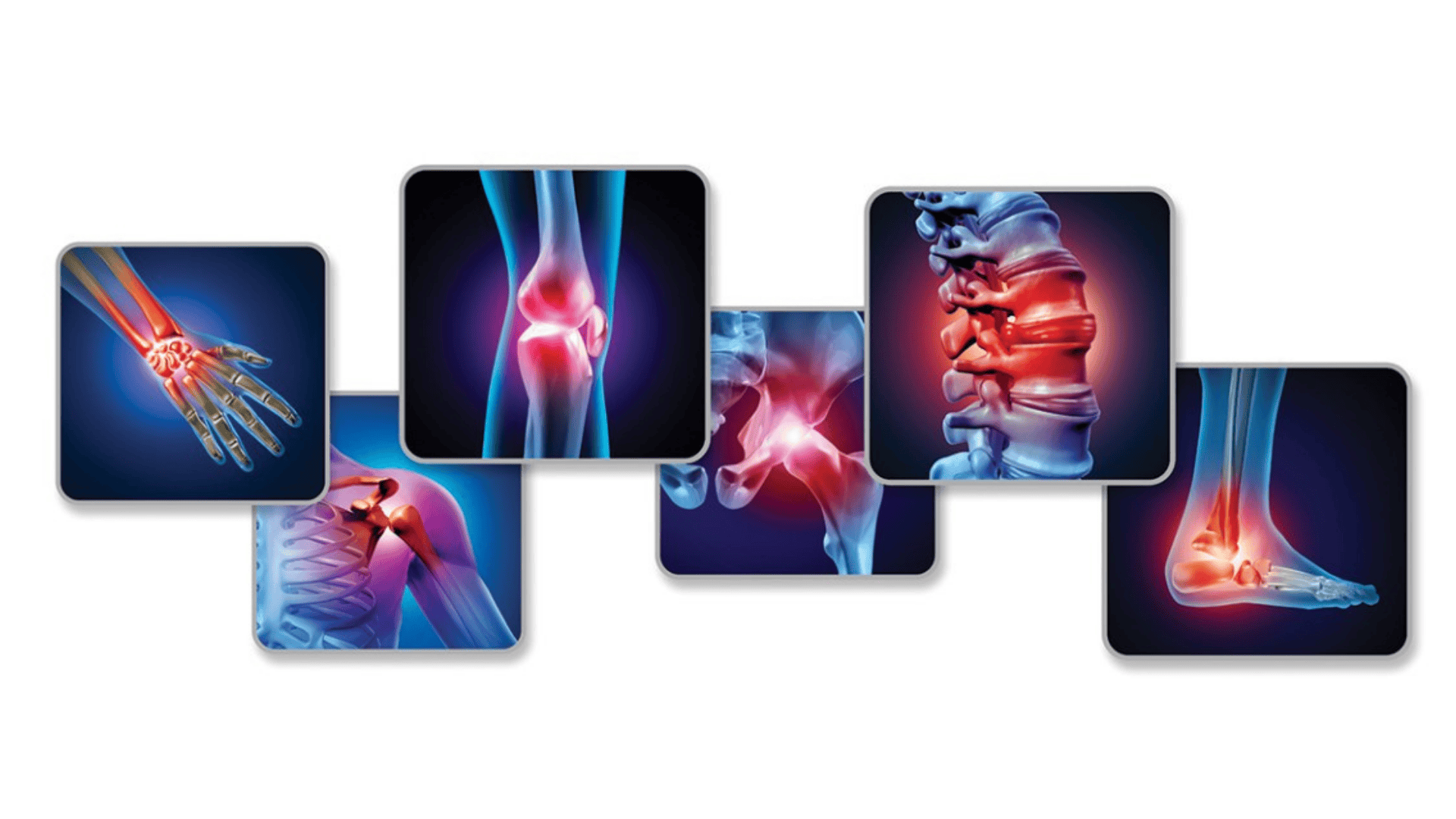 bolesti kloubů a kostí na těle