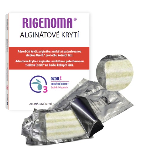 Rigenoma alginátové krytí – moderní krytí na rány s patentovanou složkou OZOILE