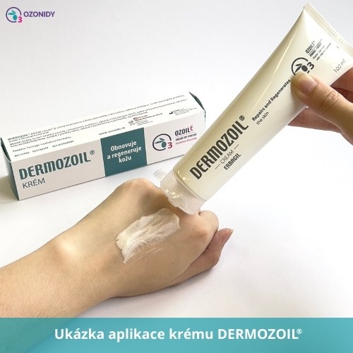 Aplikace DERMOZOIL krém